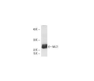 MYL3 Antibody (MLM520) - Western Blotting - Image 10831