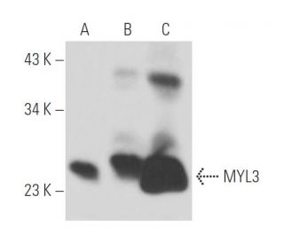 MYL3 Antibody (MLM544) - Western Blotting - Image 15576
