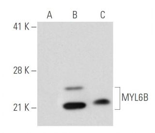 MYL6B Antibody (YY-06) - Western Blotting - Image 21013