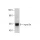 myocilin Antibody (C-1) - Western Blotting - Image 386846 