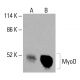MyoD 抗体 (E-1):sc-377186。通过 Western blot 分析 TE671 (A) 和 SJRH30 (B) 完整细胞裂解物中 MyoD 的表达。(B) 细胞裂解液中 MyoD 的表达。使用的检测试剂:m-IgG1 BP-HRP:sc-525408。 MyoD Antibody (E-1) - Western Blotting - Image 415896