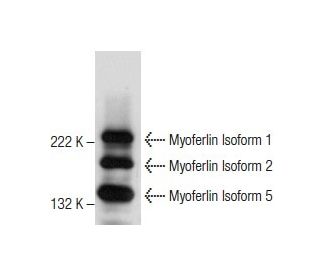 Myoferlin Antibody (D-11) - Western Blotting - Image 281208 