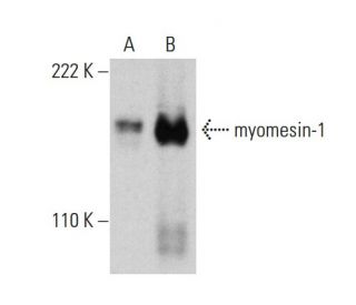 myomesin-1 Antibody (4F5) - Western Blotting - Image 384285 