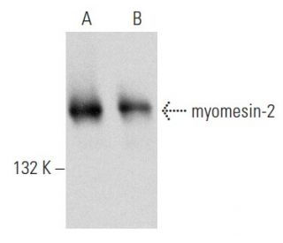 myomesin-2 Antibody (E-5) - Western Blotting - Image 354290SAM Transcription Activation: SAM system utilizing dCas9-VP64, MS2-P65-HSF1, and sgRNA for precise gene transcription activation. 