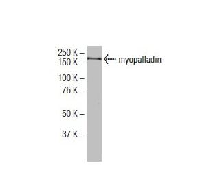 myopalladin Antibody (72-J) - Western Blotting - Image 33463