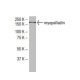 myopalladin Antibody (72-J) - Western Blotting - Image 33463