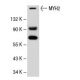 Myosin-2/MYH2 Antibody (6D595) - Western Blotting - Image 52050