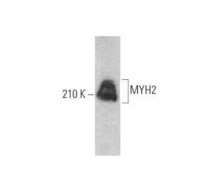 Myosin-2/MYH2 Antibody (6D595) - Western Blotting - Image 353301 