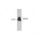 Myosin-2/MYH2 Antibody (6D595) - Western Blotting - Image 353301 