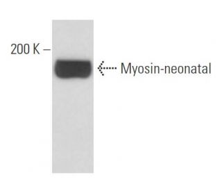 Myosin-neonatal Antibody (N1.551) - Western Blotting - Image 17490