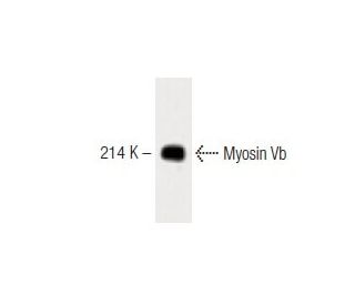 Myosin Vb Antibody (18) - Western Blotting - Image 60369 