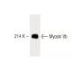 Myosin Vb Antibody (18) - Western Blotting - Image 60369 