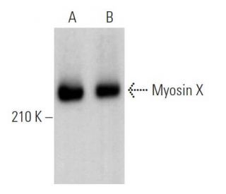 Myosin X Antibody (C-1) - Western Blotting - Image 363781Each CRISPR/Cas9 Knockout (KO) Plasmid product consists of a pool of 3 plasmids designed to ensure identification and cleavage of a specific gene for maximum knockout efficiency. Each plasmid encodes a unique 20 nt sequence derived from the GeCKO (v2) library.