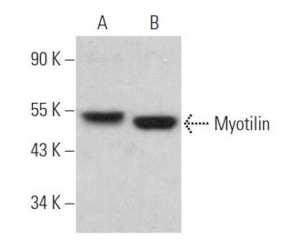 Myotilin Antibody (B-3) - Western Blotting - Image 367449