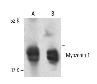 Myozenin 1 Antibody (8) - Western Blotting - Image 399331 