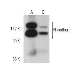 N-cadherin Antibody (8C11) - Western Blotting - Image 377742 