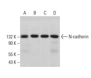 N-cadherin Antibody (13A9) - Western Blotting - Image 379001