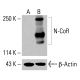 N-CoR 抗体 (E-6):sc-518134。未经处理 (A) 和经化学处理 (B) 的 HeLa 全细胞裂解液中 N-CoR 表达的 Western blot 分析。所用检测试剂:m-IgGκ BP-HRP:sc-516102。β-肌动蛋白 (C4):sc-47778 用作内参。所用检测试剂:m-IgG Fc BP-HRP:sc-525409。 N-CoR Antibody (E-6) - Western Blotting - Image 416492