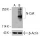 N-CoR 抗体 (E-6):sc-518134。未经处理(A)和经化学处理(B)的 K-562 全细胞裂解液中 N-CoR 表达的 Western blot 分析。所用检测试剂:m-IgGκ BP-HRP:sc-516102。β-肌动蛋白(C4):sc-47778用作内参。所用检测试剂:m-IgG Fc BP-HRP:sc-525409。 N-CoR Antibody (E-6) - Western Blotting - Image 416493