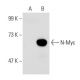 N-Myc Antibody (NCM II 100) - Western Blotting - Image 40808