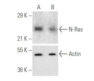 N-Ras siRNA (h): sc-36004. Western blot analysis of N-Ras expression in non-transfected control (A) and N-Ras siRNA transf 