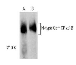 N-type Ca<sup>++</sup> CP &alpha;1B Antibody (A-2) - Western Blotting - Image 369324 