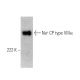 Na+ CP type VIIIα Antibody (W-78) - Western Blotting - Image 367981 