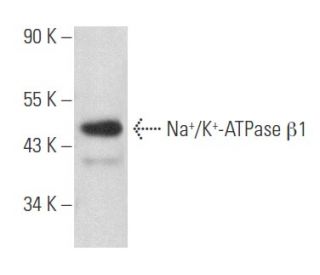 beta 1 Sodium Potassium ATPase/ATP1B1 Antibody (3C115) - Western Blotting - Image 357484 