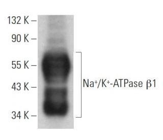 beta 1 Sodium Potassium ATPase/ATP1B1 Antibody (6D136) - Western Blotting - Image 379257 