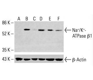 beta 1 Sodium Potassium ATPase/ATP1B1 Antibody (E-4) - Western Blotting - Image 414771 