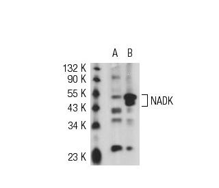 NADK Antibody (J-07) - Western Blotting - Image 50672