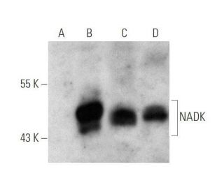 NADK Antibody (J-07) - Western Blotting - Image 351727 