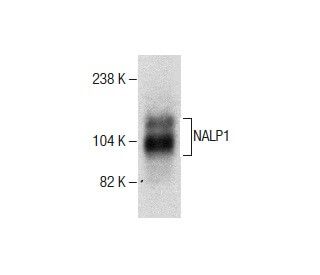 NALP1 Antibody (F-1) - Western Blotting - Image 286728
