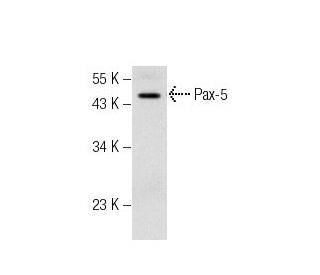 Pax-5 (N-19): sc-1975. Western blot analysis of Pax-5 expression in NAMALWA whole cell lysate. 