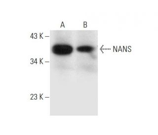 NANS Antibody (B-6) - Western Blotting - Image 309553 