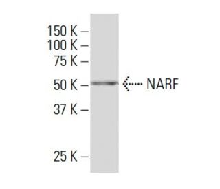 NARF Antibody (32-7) - Western Blotting - Image 34024Each CRISPR/Cas9 Knockout (KO) Plasmid product consists of a pool of 3 plasmids designed to ensure identification and cleavage of a specific gene for maximum knockout efficiency. Each plasmid encodes a unique 20 nt sequence derived from the GeCKO (v2) library.