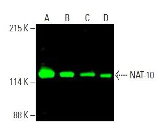 NAT-10 Antibody (B-4) - Western Blotting - Image 396056 