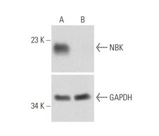 NBK CRISPR/Cas9 KO Plasmid (h): sc-401751. Western blot analysis of human NBK expression in empty vector control (A) and NEach CRISPR/Cas9 Knockout (KO) Plasmid product consists of a pool of 3 plasmids designed to ensure identification and cleavage of a specific gene for maximum knockout efficiency. Each plasmid encodes a unique 20 nt sequence derived from the GeCKO (v2) library.
