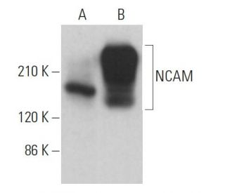 NCAM/CD56 Antibody (123A8) - Western Blotting - Image 379344 