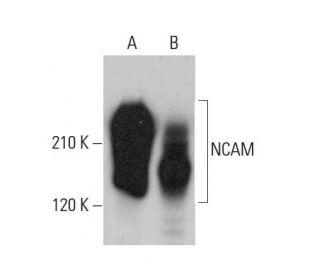 NCAM/CD56 Antibody (123C3) - Western Blotting - Image 379848 