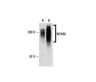 NCAM/CD56 Antibody (2Q692) - Western Blotting - Image 17832 