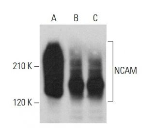 NCAM/CD56 Antibody (B332) - Western Blotting - Image 379851 