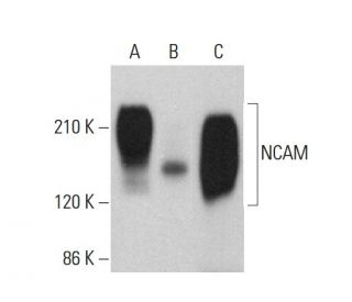 NCAM/CD56 Antibody (ERIC 1) - Western Blotting - Image 379854 
