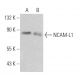NCAM-L1 Antibody (2Q789) - Western Blotting - Image 370525