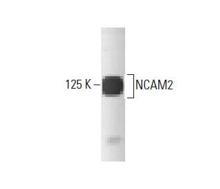 NCAM2 Antibody (44) - Western Blotting - Image 133202