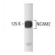 NCAM2 Antibody (44) - Western Blotting - Image 133202