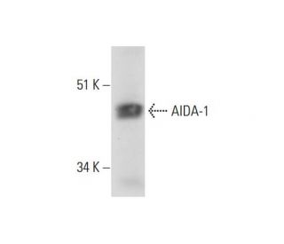 NCI-H292 Whole Cell Lysate: sc-364179. Western blot analysis of AIDA-1... 