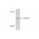 NCI-H292 Whole Cell Lysate: sc-364179. Western blot analysis of hCAP-H...