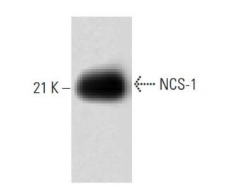 NCS-1 Antibody (1) - Western Blotting - Image 60378