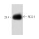 NCS-1 Antibody (1) - Western Blotting - Image 60378